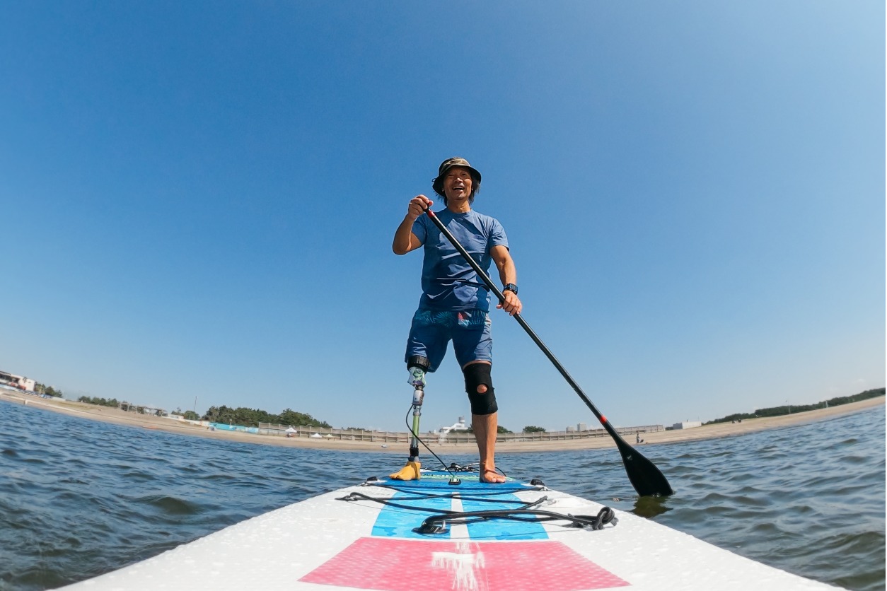 Image of amputee with prosthetic leg on a stand up paddle board.
